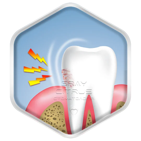 Герметизація емалі - зниження чутливості зубів